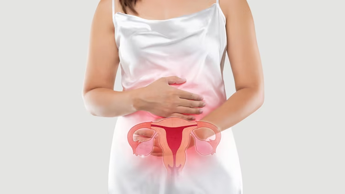 Uterine Fibroid Causes : கருப்பை கட்டி எதனால் வருகிறது தெரியுமா?