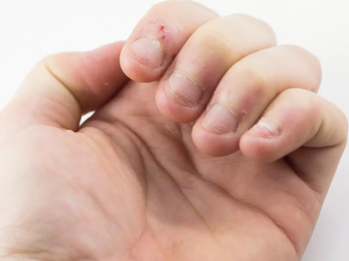 nakhoon chabane ke sanket