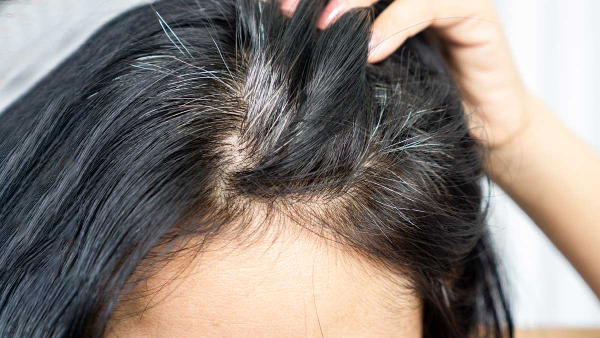 Hair Fall: सफेद और झड़ते बालों से हैं परेशान? इन पत्तों में छिपा है समाधान