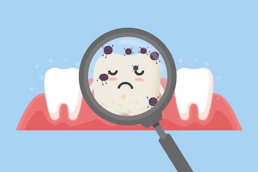 apple cider vinegar can cause tooth decay