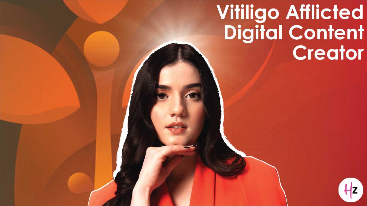 Aastha Shah: Transforming Challenges Into Creativity; The Inspiring Journey Of A Digital Content Creator With Vitiligo