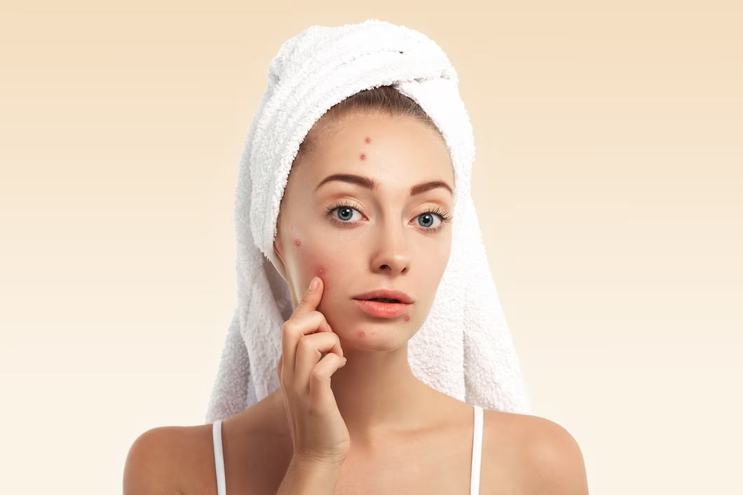 how to use besan for acne problem