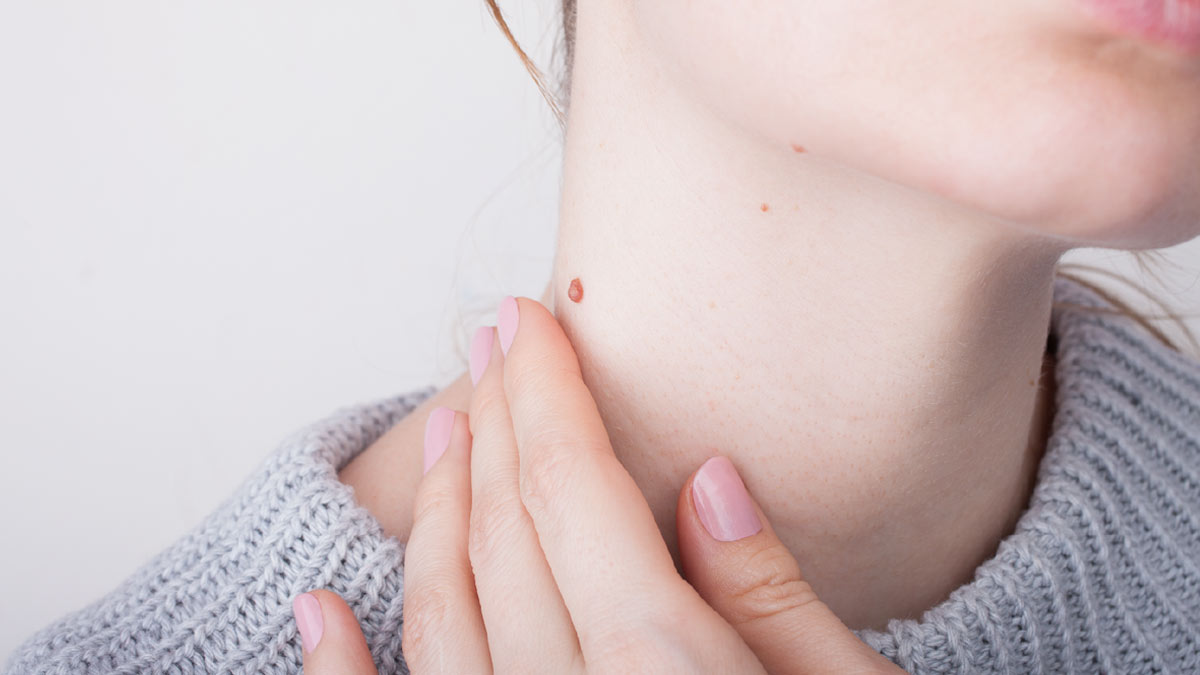 moles on body represents bad luck in hindi