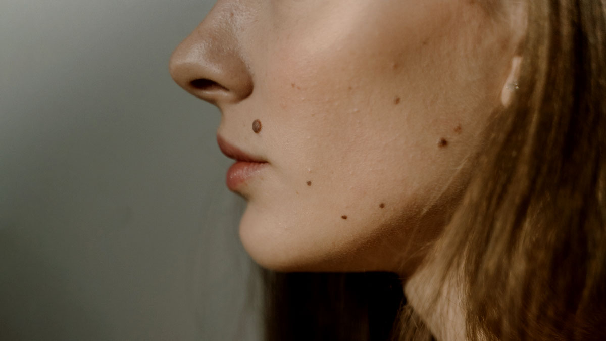 moles on body represents bad luck