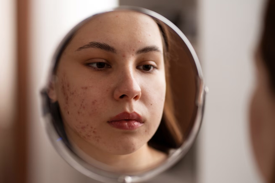 how to use mulethi for dark spots