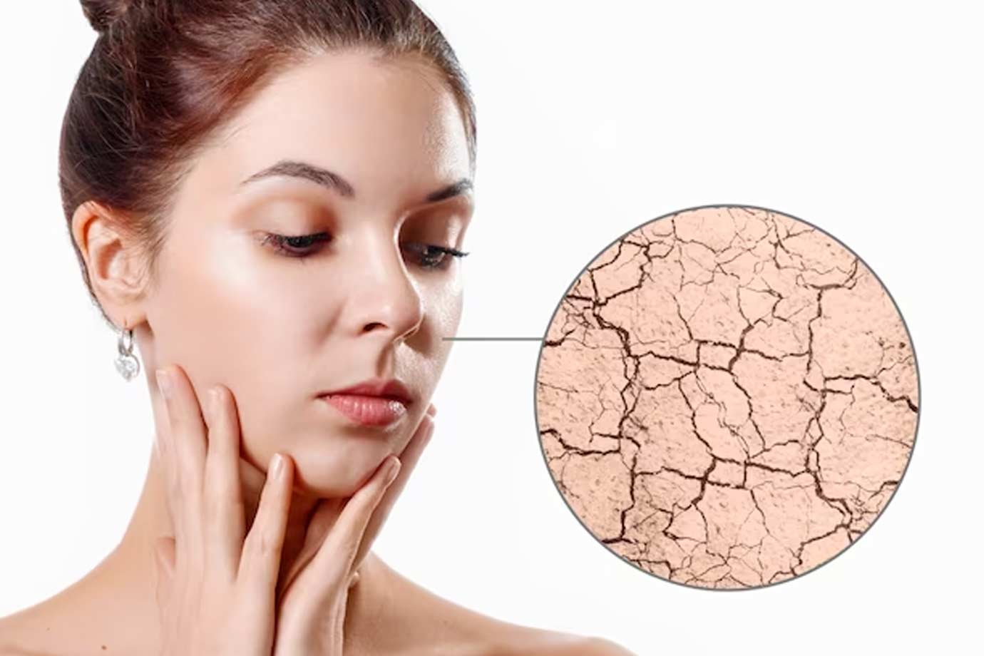 unhealthy lifestyle cause drys skin