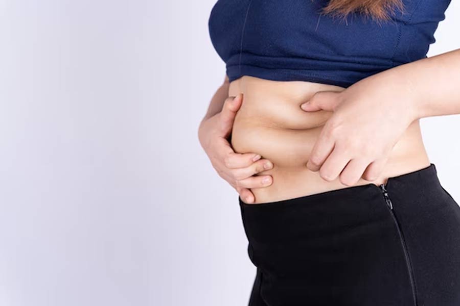 what is visceral fat