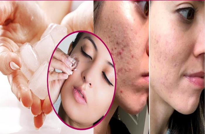 ice cube facial trick