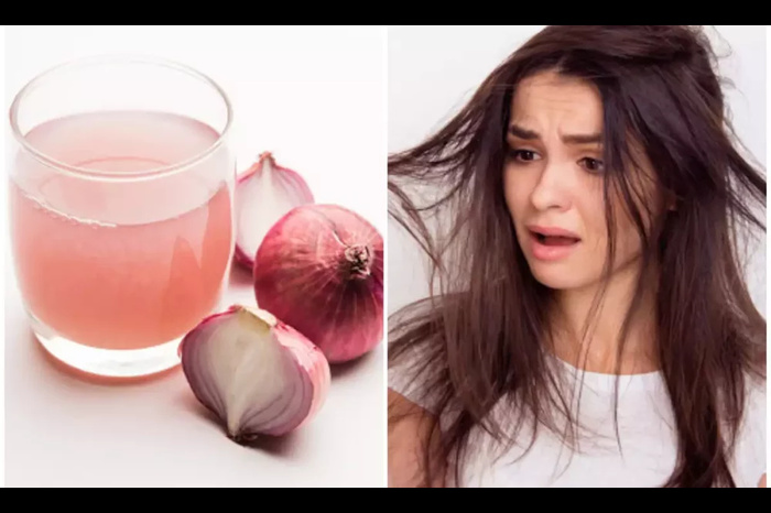 red onion prevents hair loss and makes hair shiny