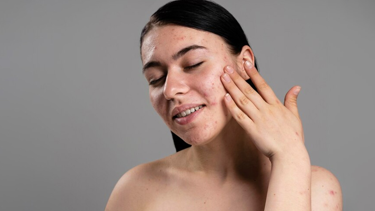 best face mask for oily skin care ideas new