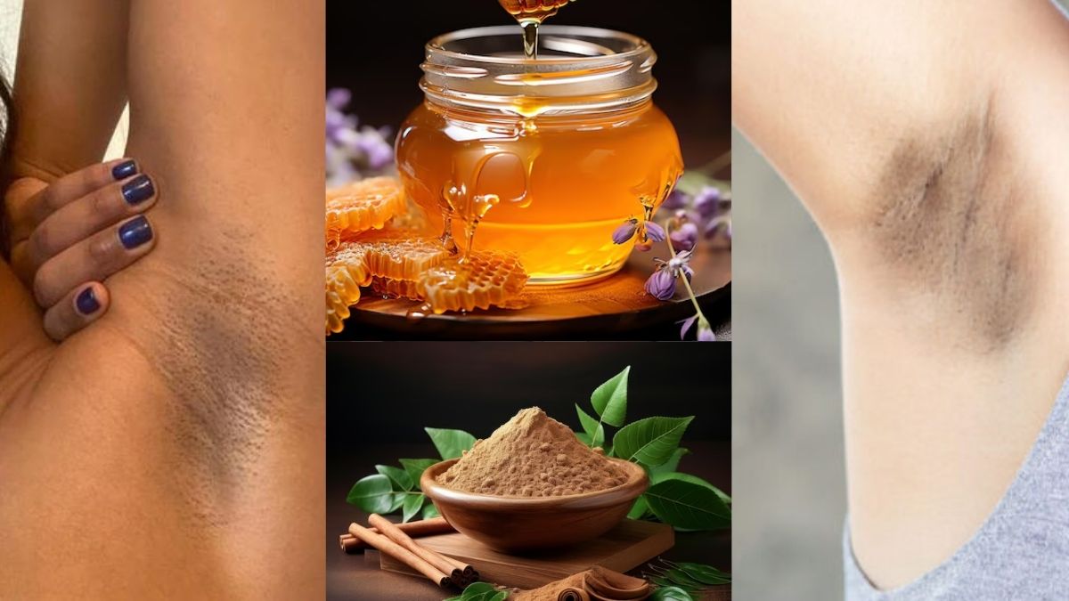 Black Underarms: काले अंडरआर्म्‍स को साफ करने के 7 नुस्‍खे | black and ...