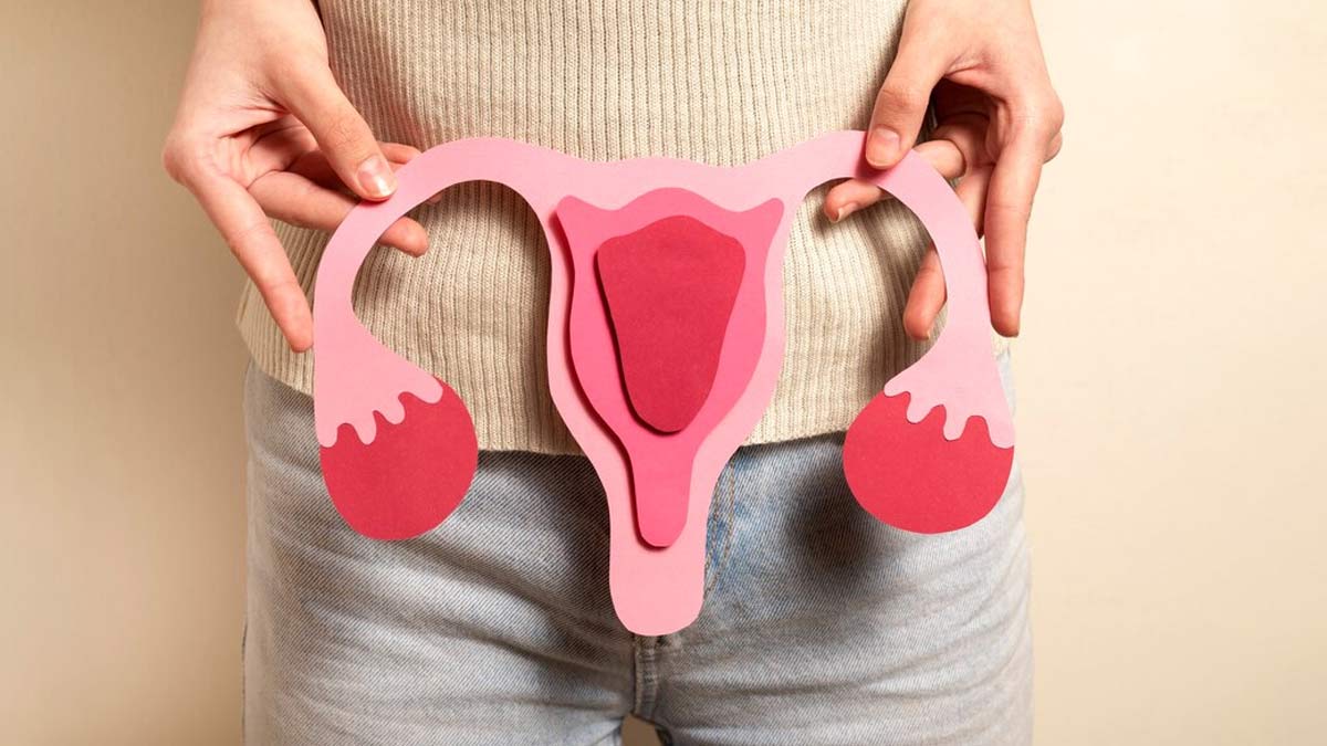 chocolate cyst details