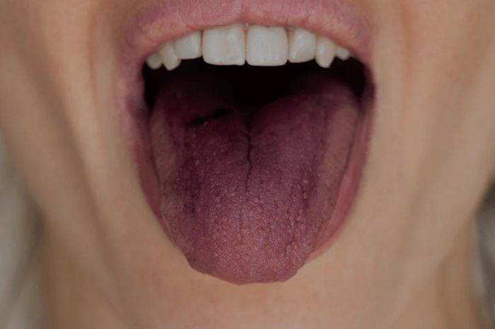 color of your tongue tells the condition of your full body health 