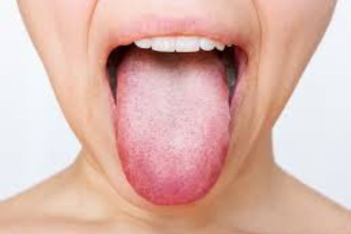 color of your tongue tells the condition of your full body health 