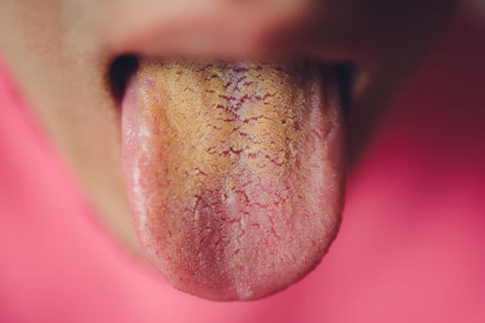 color of your tongue tells the condition of your full body health 