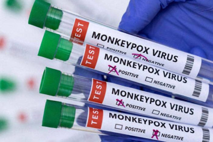 mpox virus monkey pox virus spread how is pox virus monkey pox symptoms and prevention 