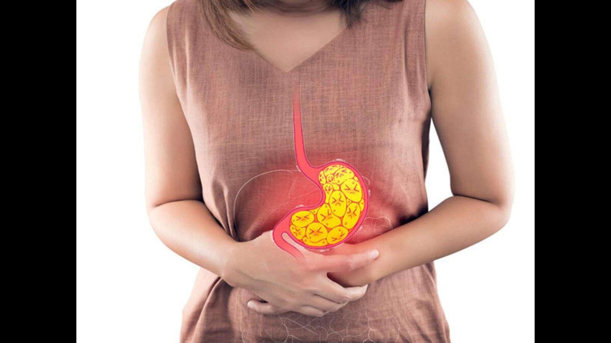 Precaution For Acid Reflux:வயிற்றில் வரும் ஆசிட் ரிஃப்ளக்ஸை சரி செய்ய உதவும் உணவுகள்!