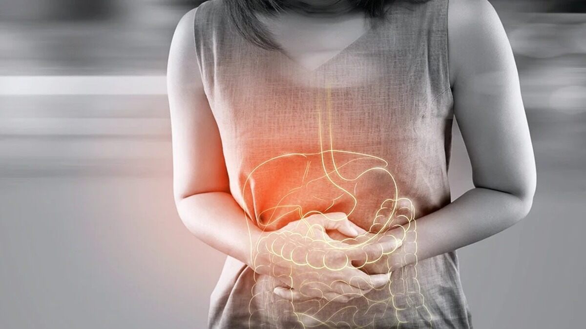 colon cancer symptoms