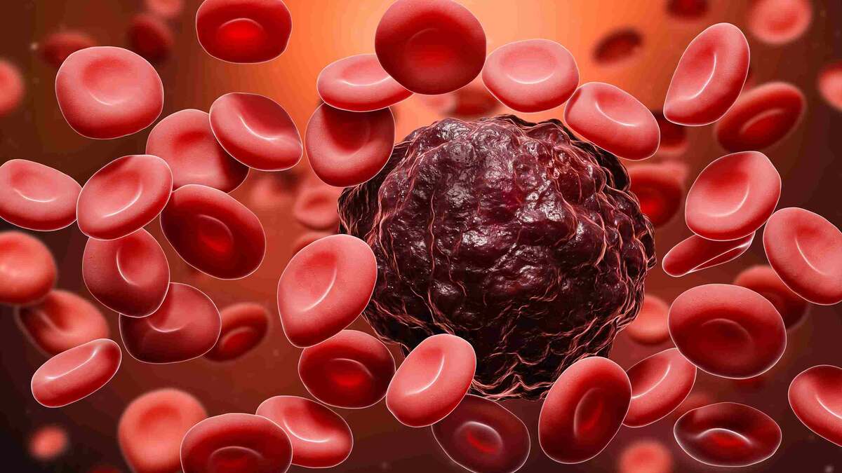 signs of blood cancer