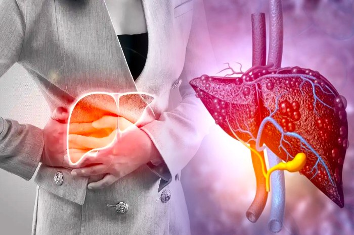 fatty liver symptoms for women