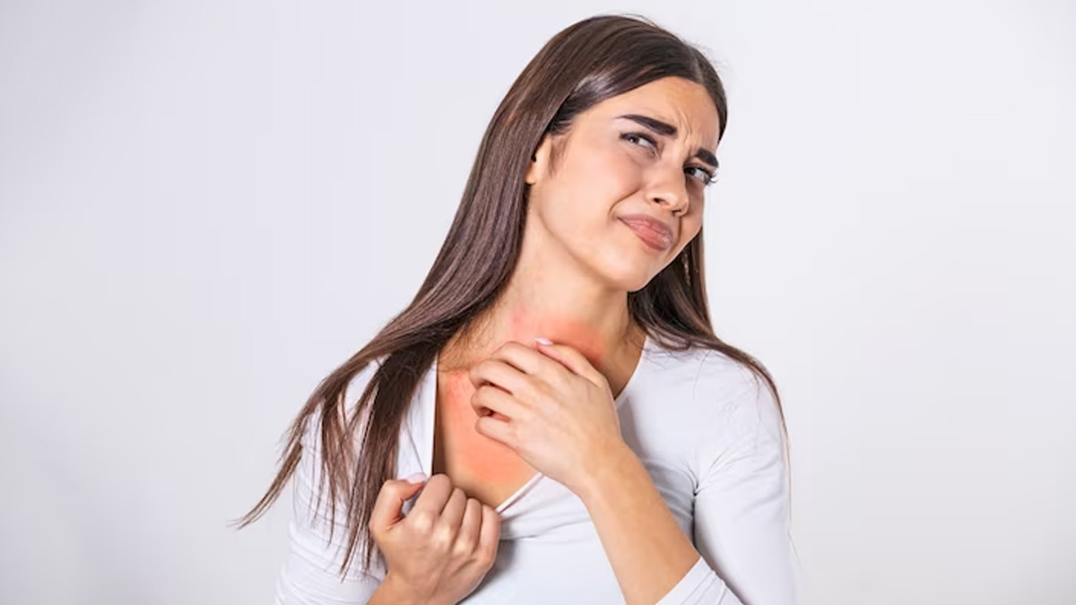 skin allergy by peanut