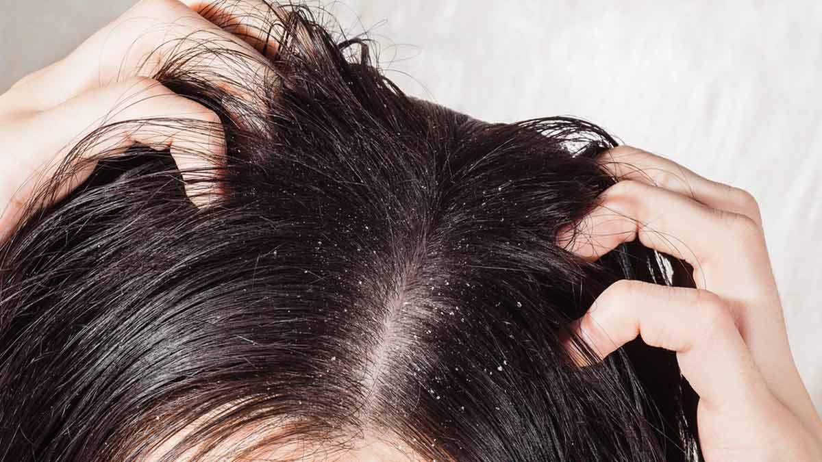 Hair Care Routine At Home: रात में सोने से पहले करें ये 5 काम, डैंड्रफ की समस्या हो जाएगी कम