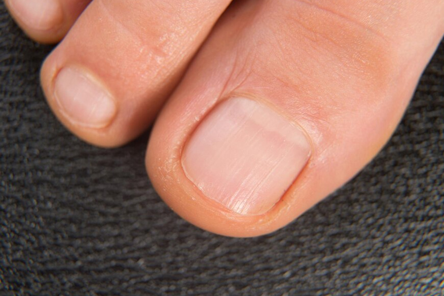 foot care during monsoon