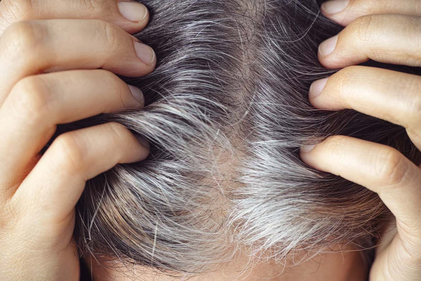 grey hair treatment