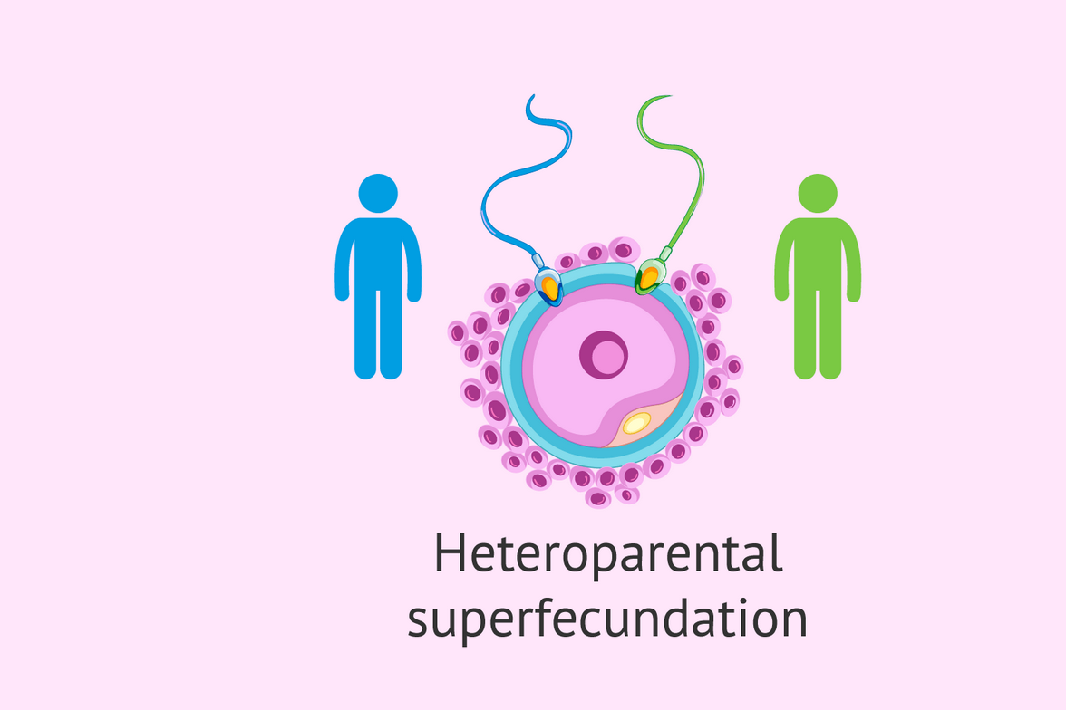 heteropaternal