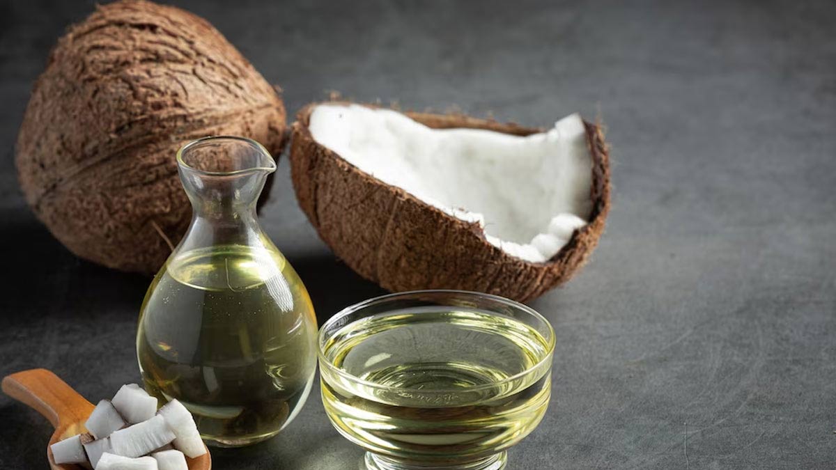 Home Remedies: Heal Burns With Coconut Oil 