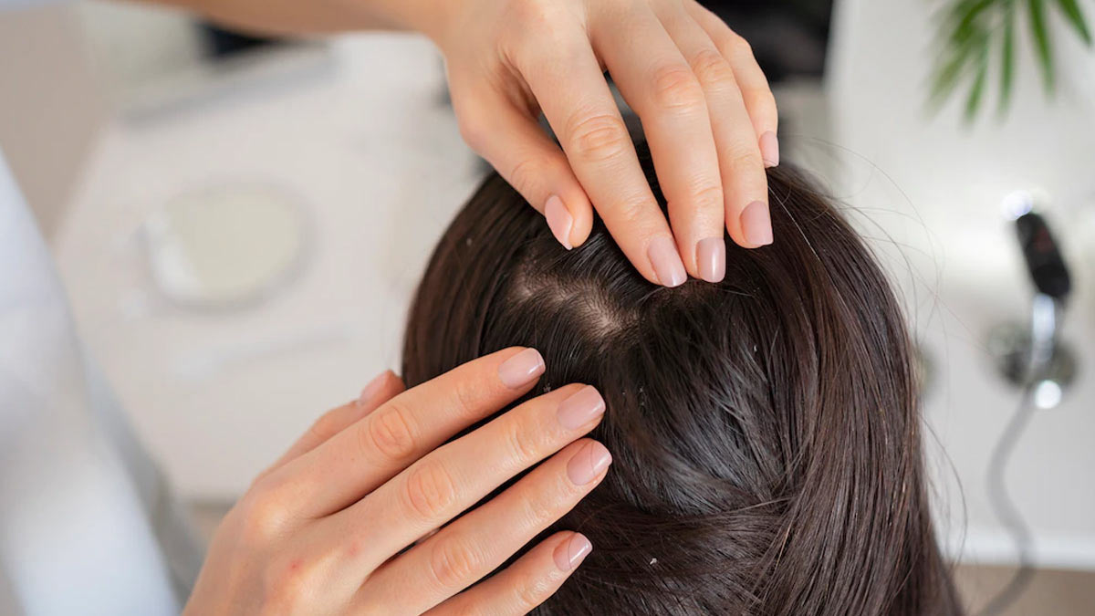 tips to scalp healthy