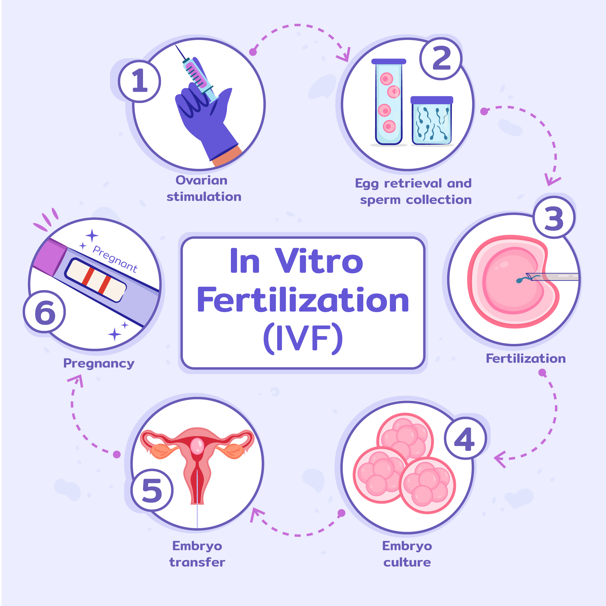 PROCESS OF IVF