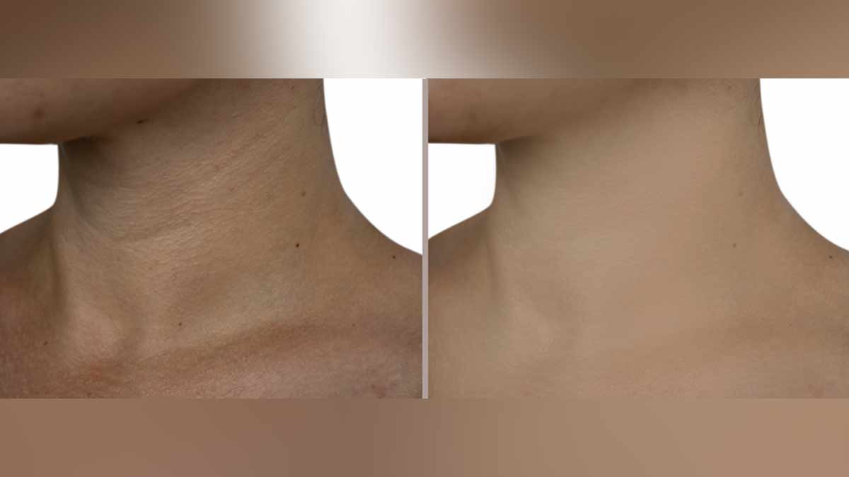 different home remedies by shahnaz husain