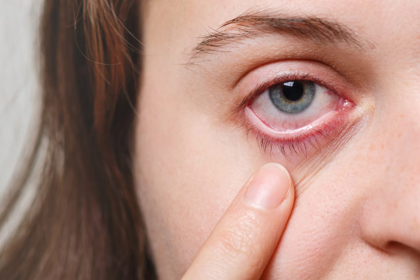 side effects of applying rose water for eyes