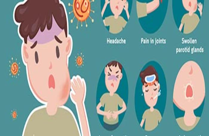 symptoms of mumps