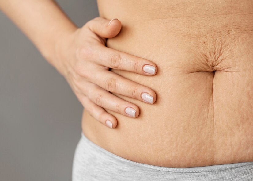 collagen for skin benefits pregnancy stretchmarks