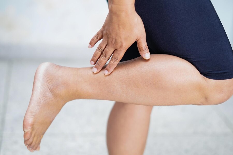 leg pain due to standing