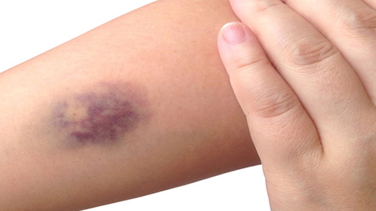 liver problems and blood clots