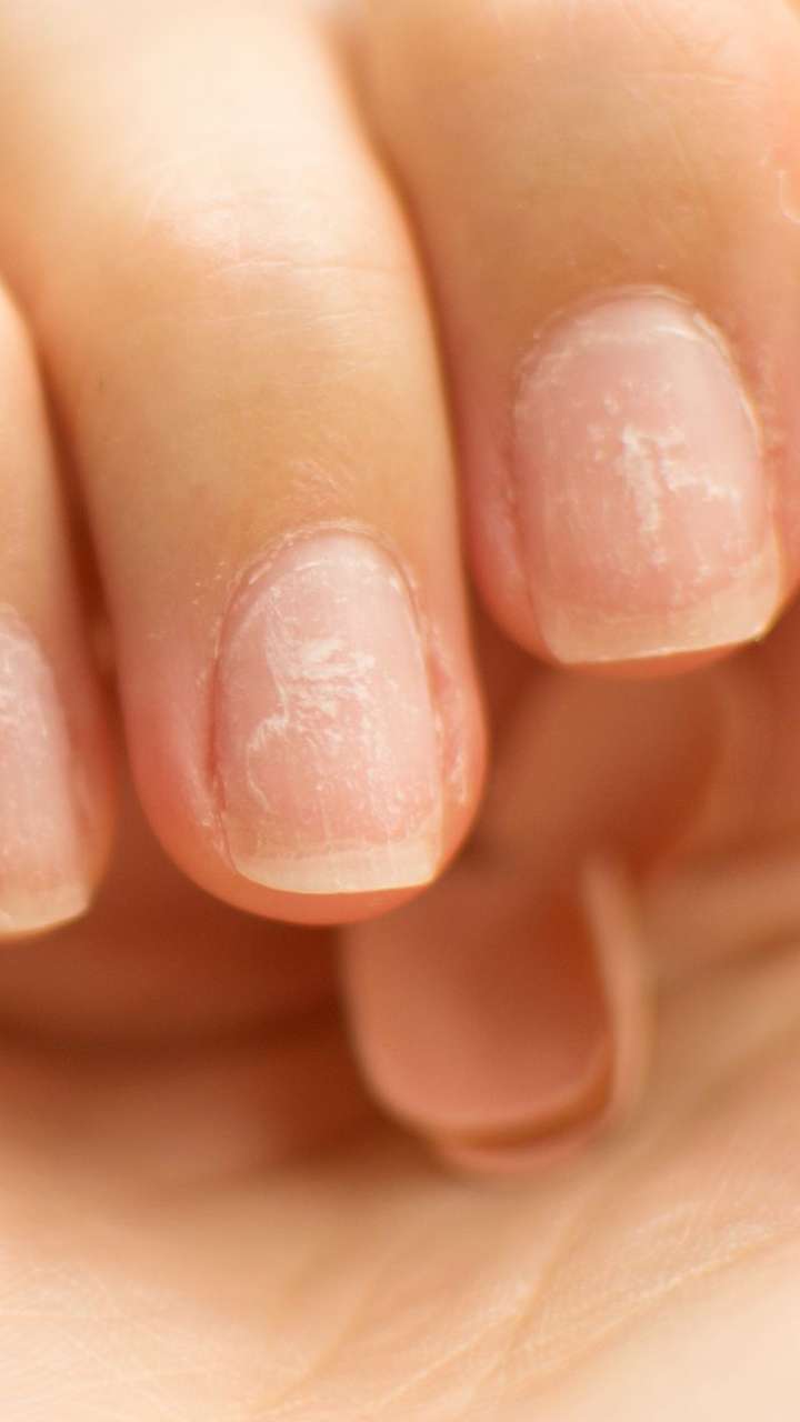 Why is the white part of my nail turning pink? - Quora