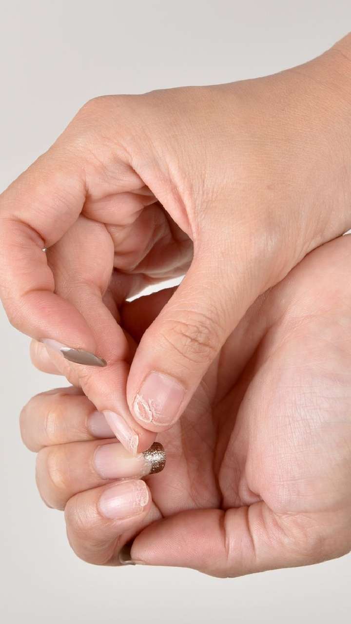 Paronychia: Causes and treatment of an infected nail