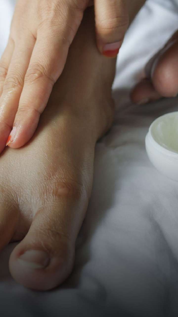 Taking Care of Eczema on Hands and Feet | Unilever Vaseline®
